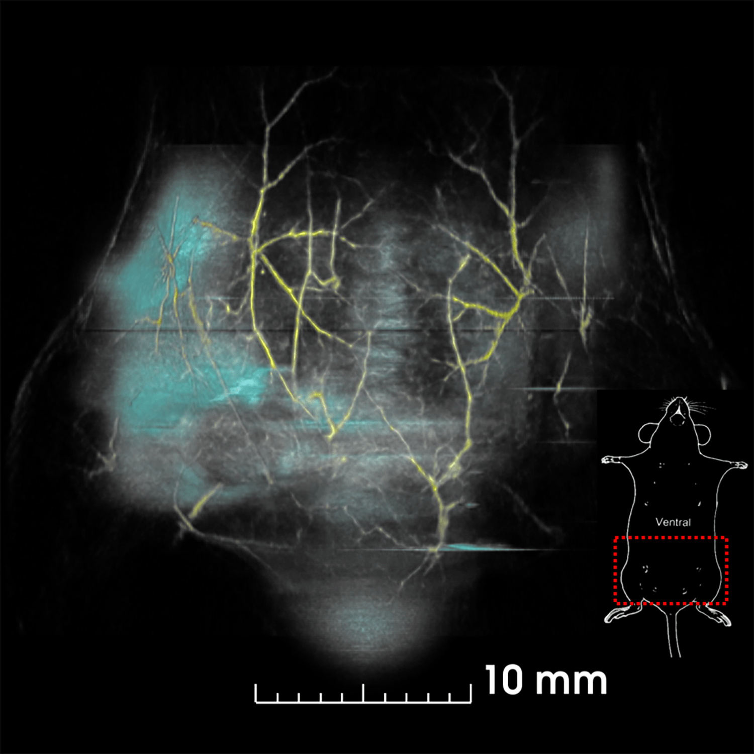 Combined Photoacoustic and Fluorescence Tomography (PAFT)