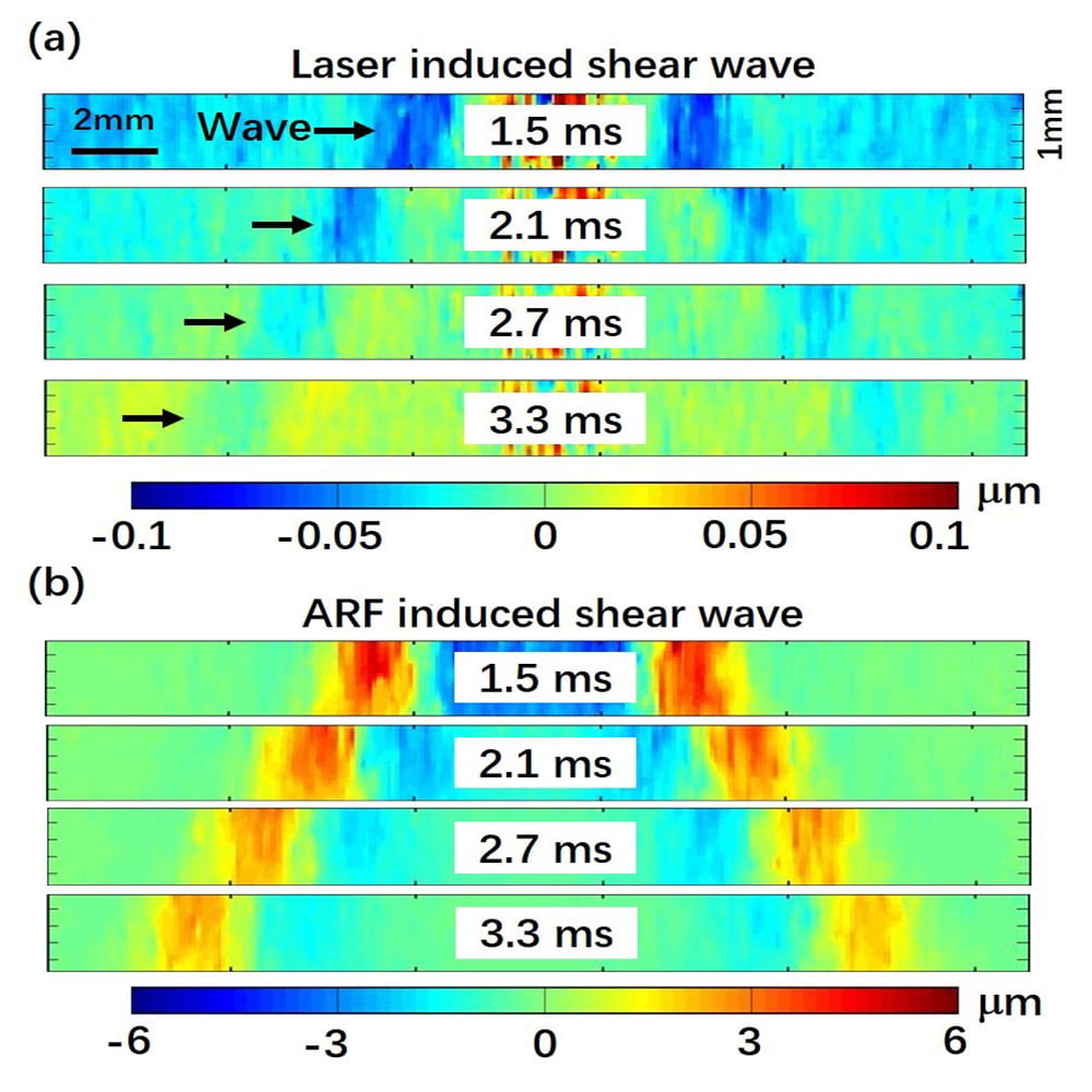 laser induced shear wave