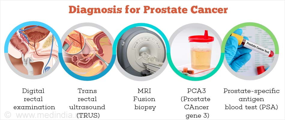 What is a prostate ultrasound